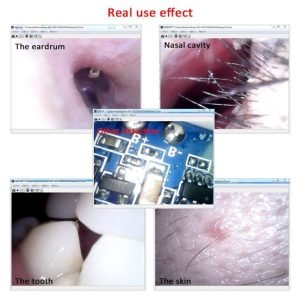 U-Kiss Kamera Endoscope HD Visual USB
